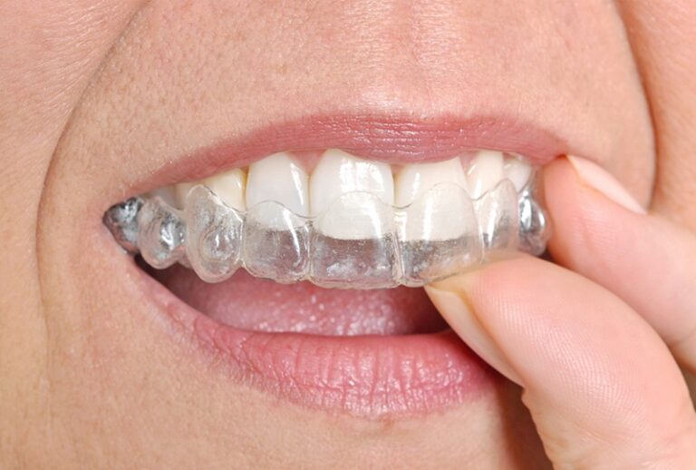 Is Gentle Realignment Effective